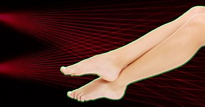 On a testé : l'épilation définitive au laser