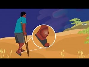 Mycetoma (Chronic inflammatory swelling)- Madura Foot ; Causes, symptoms, Diagnosis, Treatment