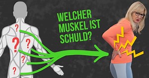 Dieser Muskel macht 91 % aller Rückenschmerzen – so dehnst du ihn auf!