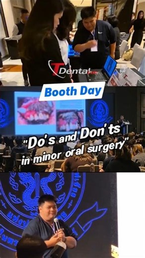 "Do's and Don'ts in minor oral surgery" / T dental Lab Booth Day 🦷 #tdentallab #omfs #oral #surgeon