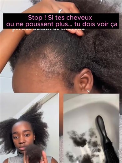 Tes cheveux ne poussent plus ou tombent par poignées ? 😫 Stop ! On a trouvé le secret pour revitaliser tes racines et booster la pousse naturellement. 🌿 Ne laisse plus tes cheveux s'affiner, redonne-leur la force qu'ils méritent ! 💪 Tu veux le même résultat?Essaies Disaar Hair Essential Oil et sens la différence au bout de 2 semaines. #viraltiktok#debloquemesvue🥲🙏🏽 #augmentersavisibilite#vue#prendssoindetescheveux