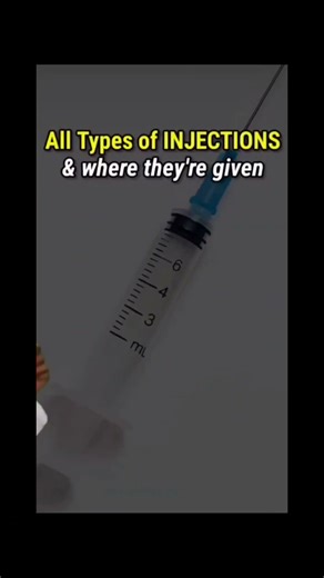 All types of injection #medical #injection #typesofinjection
