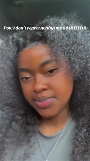 Still love them ! 🥹#GOLDTEETH