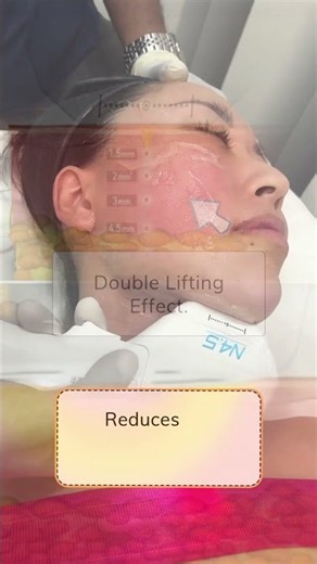 Lift, contour and define with HIFU + MFU + RF at Glowwis Aesthetic & Medical Clinic