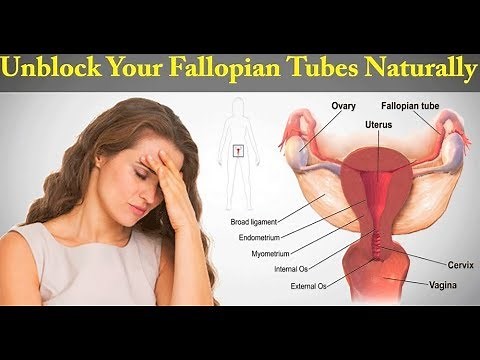 How To Unblock Fallopian Tube Naturally Without Surgery (Using Yoga, Diet & Fertility Massage)