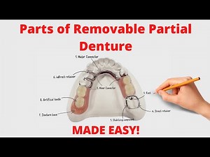 Parts of Removable Partial Denture (Cast Partial Denture)
