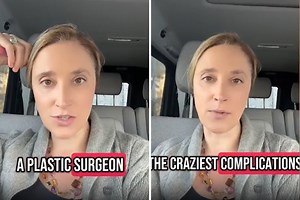 Terrifying Moment Plastic Surgeon Notices Lip Filler Went Dangerously Wrong