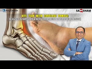 ATFL Tear with Cartilage Damage Causes, Symptoms & Best Treatment Options Explained