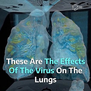 717K views · 600 reactions | This is how the virus affects your lungs, according to 3D images taken of an infected patient  | Cultura Colectiva + | Facebook
