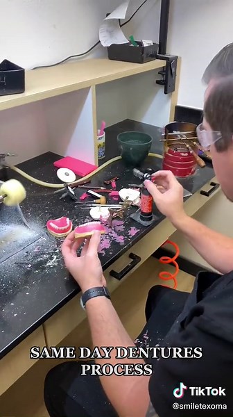 Behind the scenes with our in-house lab technicians - see how they make dentures and have them ready for patients that SAME DAY they come in! 🙌🏼 (We don’t like the idea of having to wait for your new teeth around here! 🙅🏻‍♀️) #dentures #denturegang #denturesatayoungage #denturesmile #samedaydentures #denturejourney #denturestory #denturelabtech #denturelabtechnician
