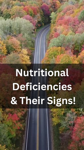 Healthtipsforall on Instagram: "Nutritional Deficiencies and Their Signs Muscle cramping: A common sign of low Magnesium, B1, B2, or B6, as these nutrients are essential for proper muscle contraction and relaxation. Twitching: Can indicate deficiencies in B1, B2, B3, B6, B9, Vitamin D, Magnesium, or Calcium, all crucial for nerve signaling and muscle function. Poor night vision: Caused by a lack of Vitamin A, which is critical for the production of rhodopsin, a pigment in the retina. Edema/Swell