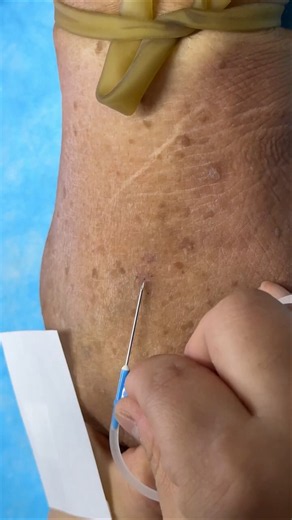 Nursing Skills: How to Give IV Inyección | Intravenous IV & IM Inyección Safely"6