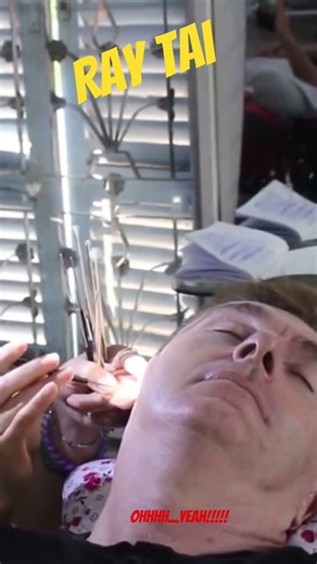 ear wax clean Vietnam #raytai #vietnamilove #travel