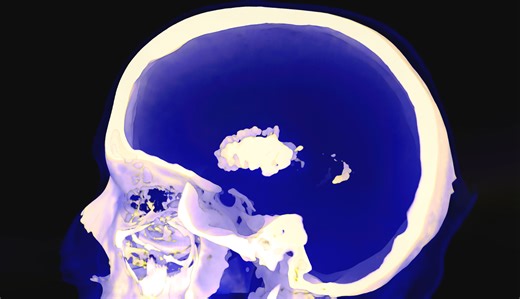 一位短视频博主吸食了奶油发泡剂，他的生活是这样毁于一旦的