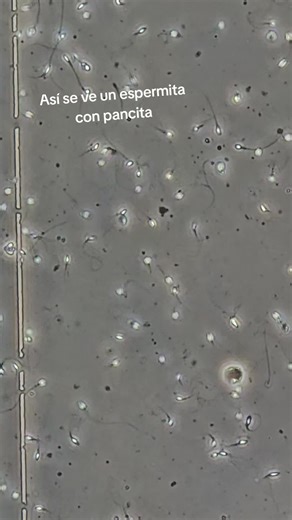 Residuo O Gota Citoplasmática: Defecto Morfológico en Espermatozoides