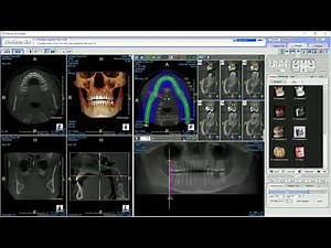 how to render panoramic from cbct scan 1080p 1