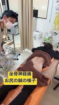坐骨神経痛に対する鍼治療の実際の様子。#坐骨神経痛#ほまれ鍼灸院