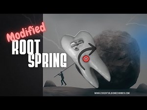 Modified Root Spring for Molar Uprighting