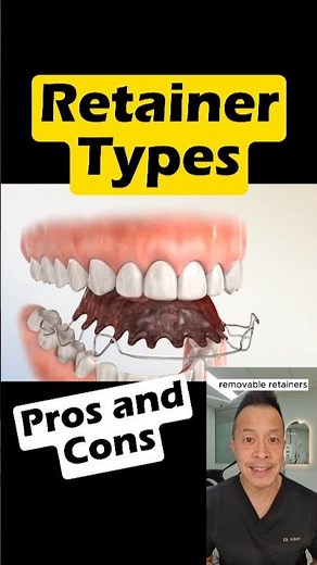 Removable vs Fixed Retainers: Pros & Cons You Need to Know #dentallan #dentist #shorts
