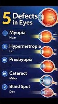 || 5 Defects in eyes|| #defects #myopia #hypermetropia #presbyopia #viralvideo #arvindsir #trending