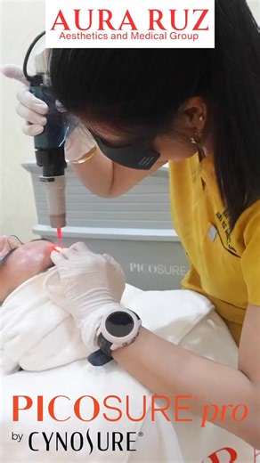 AURA RUZ PICOSURE PRO LASER ✨ 3× More Powerful Than the Original PicoSure — for True, Branded Results 💖 Experience the next-level glow with the gold standard laser for: ✔️ Melasma, Acne & Acne Scars ✔️ Wrinkles & Skin Tightening ✔️ Stretch Marks & Freckles ✔️ Large Pores & Oily Skin Control ✔️ Dark Underarms, Elbows, and Leg Scars ✔️ Skin Rejuvenation & Brightening ✔️ Tattoo & Birthmark Removal 💫 Less downtime. More collagen. Real results. 💫 Better than Revlite, Carbon Laser, and Fake Pico La