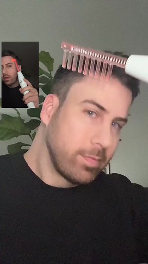 Effective Anti-Aging Routine with Nuderma Professional Wand