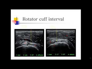 shoulder ultrasound examination. shoulder ultrasonography