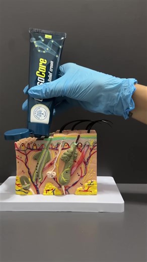 Introducing CapsaCare Neuropathy Relief Cream – a revolutionary topical solution with our proprietary NeuroSoothe Formula™ to help… ✅ Eliminate burning & tingling – interrupt pain signals and calm overactive nerves ✅ Restore normal sensation – improve circulation to damaged nerve endings ✅ Sleep through the night – enjoy hours of sustained relief without disruption ✅ Move freely again – reduce nerve-related pain and improve mobility ✅ Target pain directly – deliver powerful ingredients exactly w