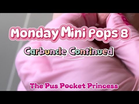 Monday Mini Pops 8 - carbuncle continued