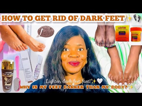HOW TO GET RID OF DARK FEET | DISCOLORATION + *Lighten Dark Body Parts* Dark feet *Black toe* |Ankle