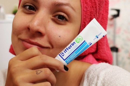 Adapaleno: Qué es, para qué sirve, nombre comercial y más - Conozcamos Las Características De Cada Una De Las Medicinas