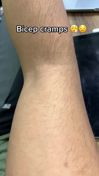 Preventing and Managing Bicep Cramps: A Complete Guide