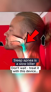 🚨 Struggling with snoring or sleep apnea? 😴 Don’t let it quietly drain your energy, damage your health, or put distance between you and the people you love. Meet SnoreSnoozer — the device that’s helping people finally get real, restorative sleep again. Unlike bulky CPAP machines or painful mouthguards that force your jaw into an unnatural position, SnoreSnoozer works by addressing the real cause of snoring. It gently holds your tongue forward while you sleep, helping keep your airway open so o