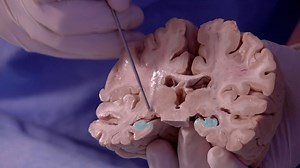 Memory vs. Intelligence — NOVA | PBS