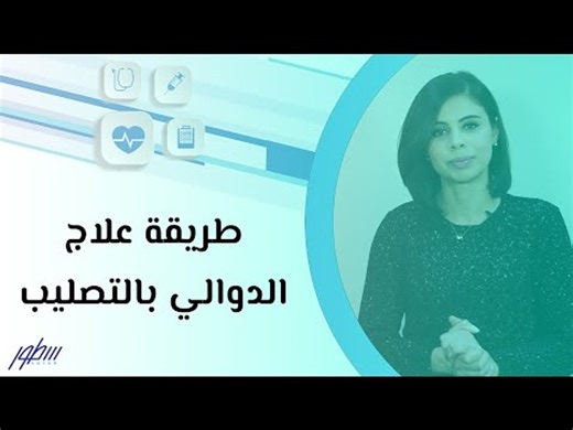 طريقة علاج الدوالي بالتصليب