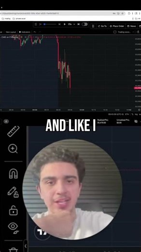 Prop Firm Trading: Master Manipulation & Maximize Profits #shorts