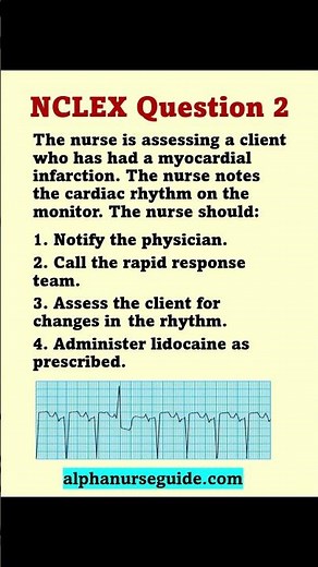 NCLEX Questions and Answers: How to recognize cardiac rhythms | NCLEX Review