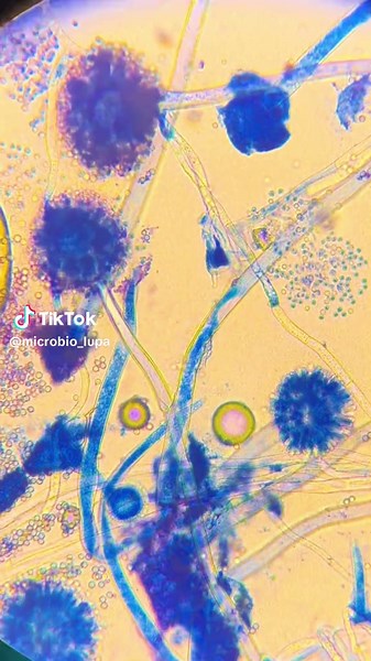 Exploring Aspergillus: Insights from the Microbiology Lab