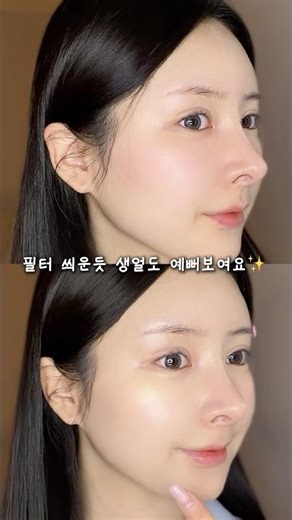 예전에 제 피부 화농성 + 염증성 여드름
