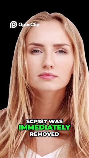 SCP-729-J Exposure: Horrific SCP-187 Transformation 😱 Bunny Breaks the Precog