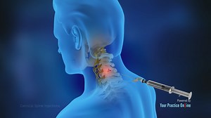 Cervical Spine Injections