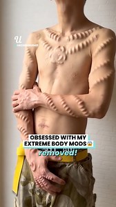 800K views · 1.9K reactions | He’s even removed his belly button  | Ultimate | Facebook