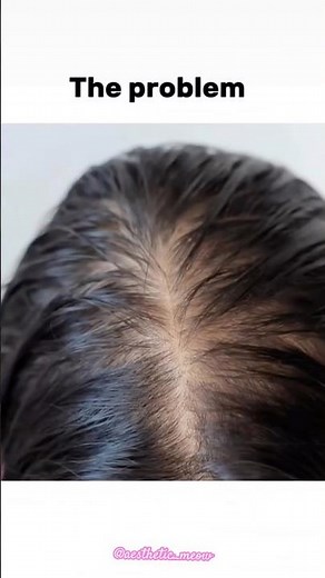 How to get long hair ✨ #longhair #thickhair #hairfall #ytshorts #explorepage #fypシ゚viral #korea