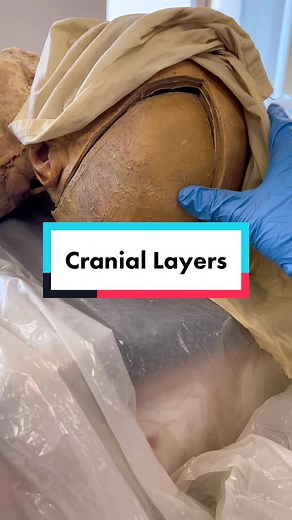 Understanding Brain Anatomy: Meninges and Cranial Layers Explained