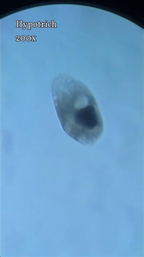 Big and fast hypotrich ciliate under the microscope #microscopy #science #ciliates