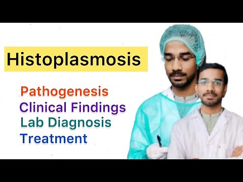 Histoplasmosis | Pathogenesis | Clinical |Diagnosis | Treatment