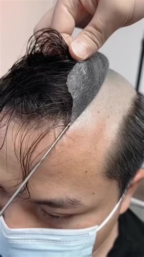 Top Solutions for Hair Loss: Explore Hairpieces