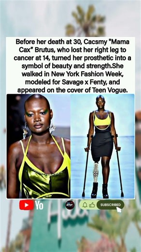 🦿💫Before Her Death at 30,Cax Turned Her Prosthetic Into a Symbol of Beauty & Strength.#yosho #shorts