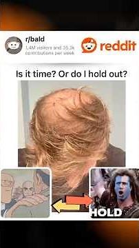 r/bald Moderator Explains the Subreddit's Key Memes