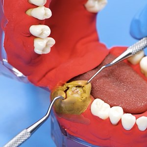 3.1M views · 4.9K reactions | Guide étape par étape de l'élimination des dents chez le dentiste | BRICO ADOS | Facebook